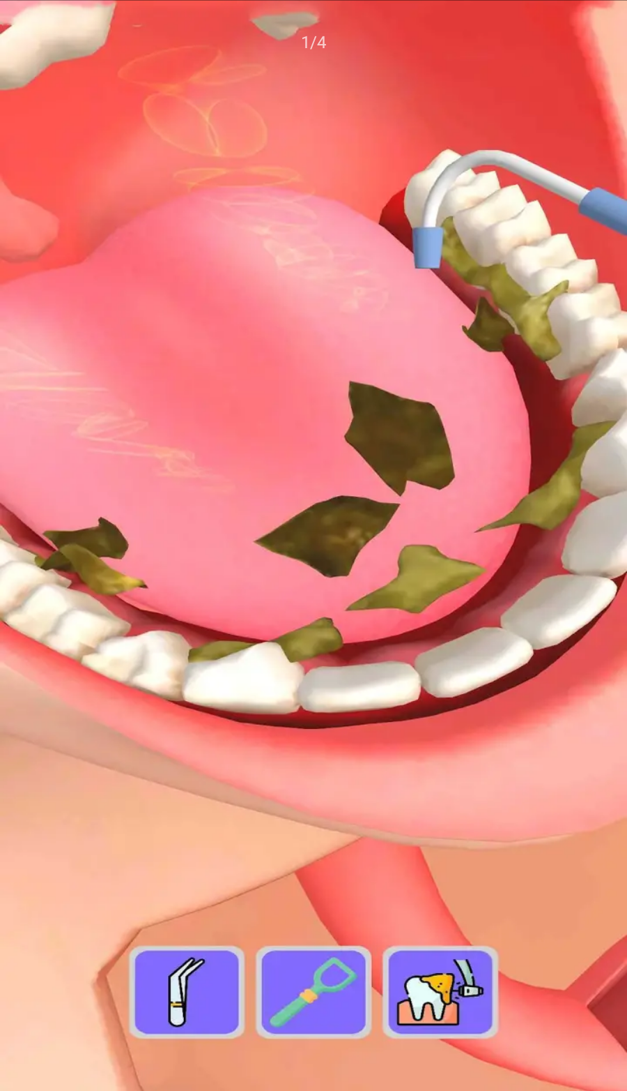 最强牙齿小游戏 2