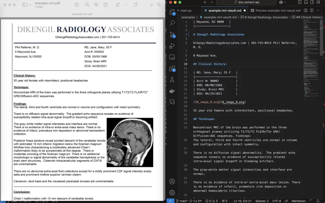 PDF Extract API：OCR文档提取与解析工具，Python+自然语言实现