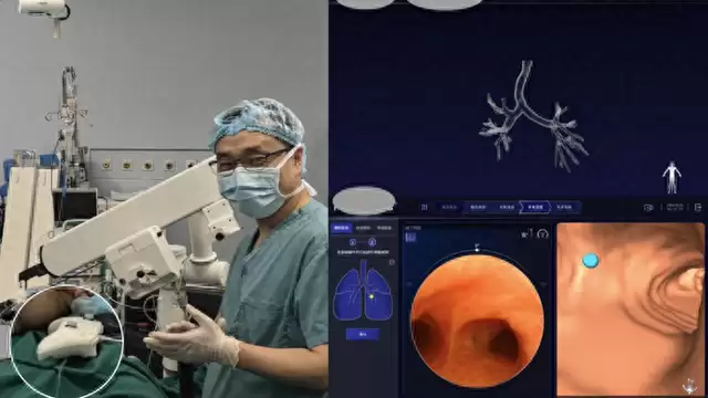 人工智能辅助胸外科手术导航探索“自动驾驶”：如何让医疗数智化再进一步？